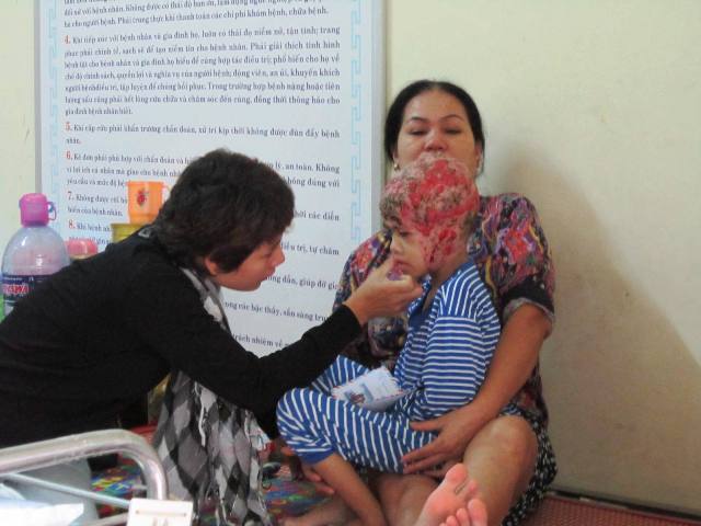 Cháu bé bị tuột da đầu có hoàn cảnh khó khăn cần giúp đỡ.